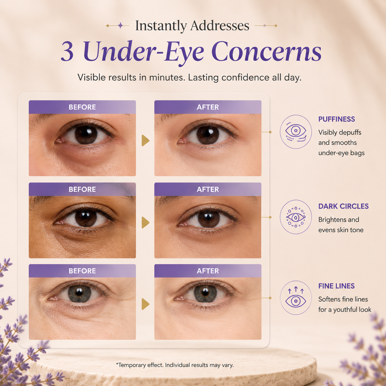 Instant Lift Eye Gel™ – Firming Eye Serum for Puffiness, Fine Lines & Under Eye Bags