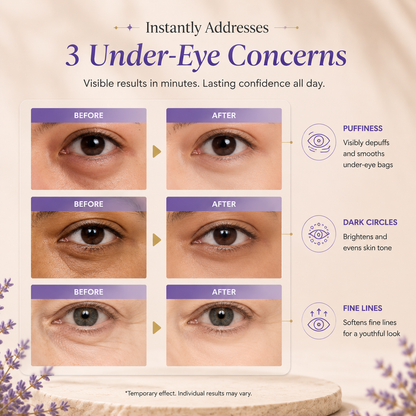 Instant Lift Eye Gel™ – Firming Eye Serum for Puffiness, Fine Lines & Under Eye Bags